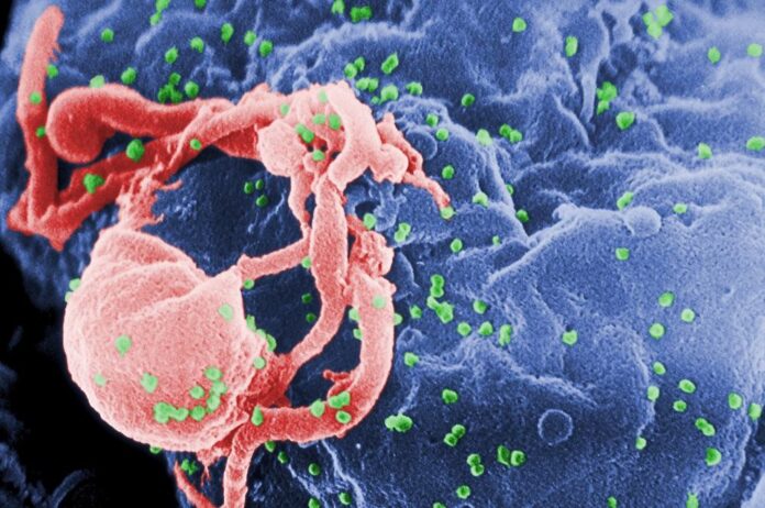اكتشاف قطعة بازل جديدة تسهم في طريق علاج مرض الإيدز